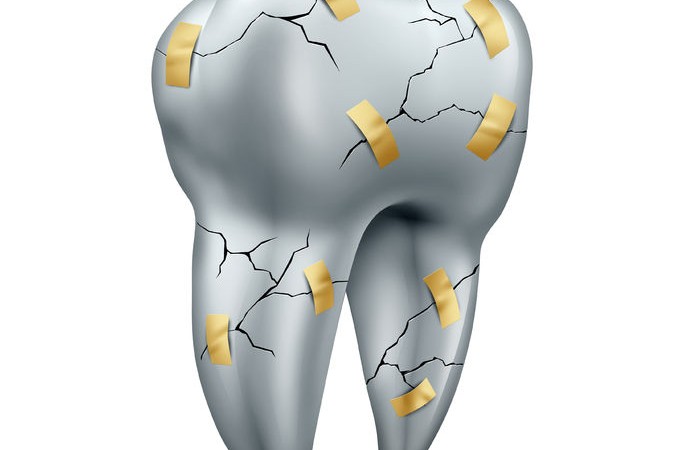 38697283 - tooth repair dental concept as a health care symbol for dentist surgery or fixing or repairing damaged teeth due to decay or cavities as a cracked molar with tape as a dentistry metaphor isolated on a white background.