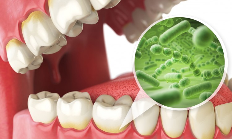 71865960 - bacterias and viruses around tooth. dental hygiene medical concept. 3d illustration