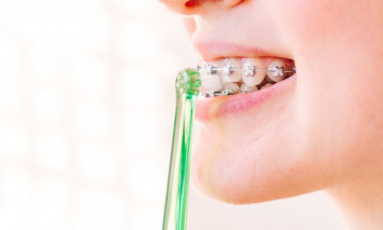 female mouth with braces closeup with green toothbrush in profile, oral care and hygiene